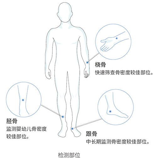 超聲骨密度儀OSTEOKJ3700S應(yīng)用領(lǐng)域